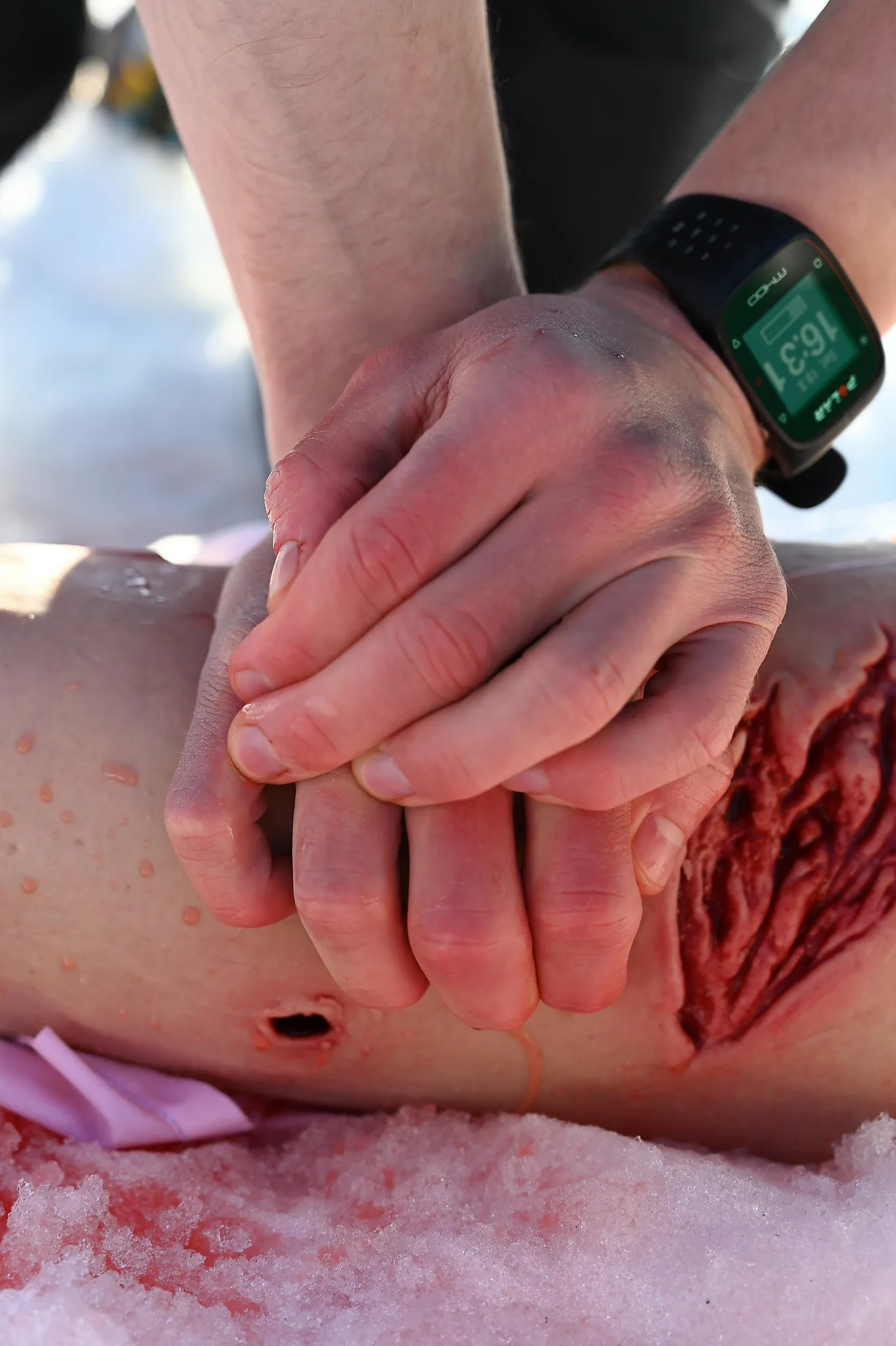 Manual compression of a wound during an exercise.