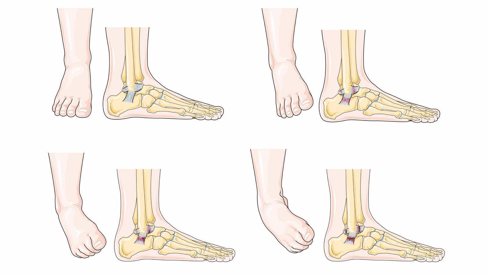 Fractures and sprains — assessment and stabilisation