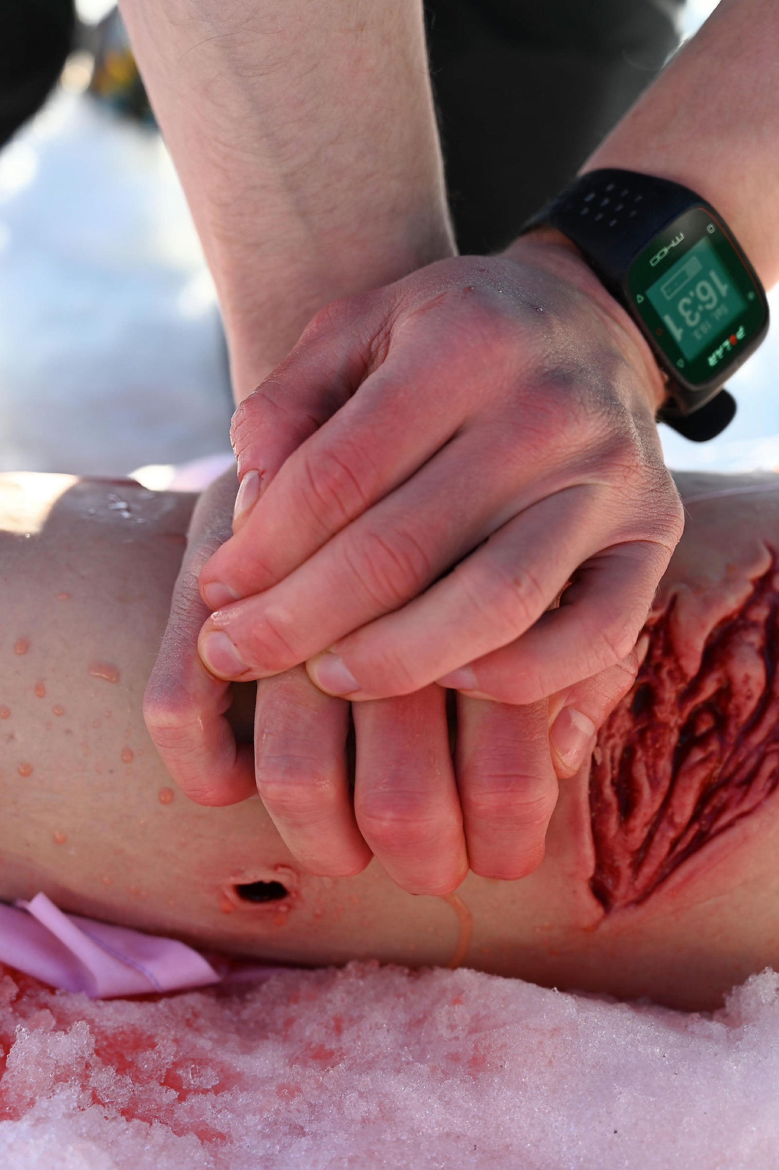 The recovery position — lifesaving first aid for an unconscious casualty